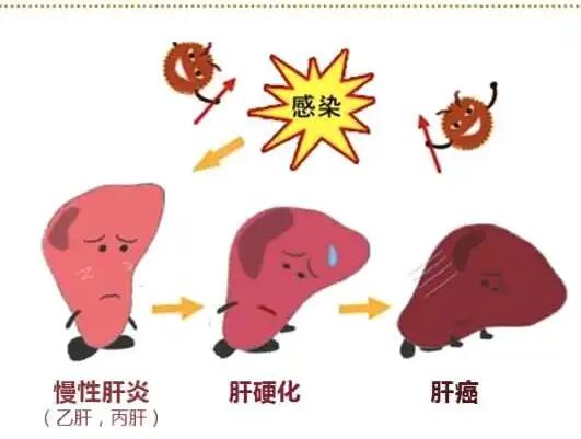 麻豆视频软件廠家提醒肝髒疾病治不好？要了解是否含鐵食物攝入多